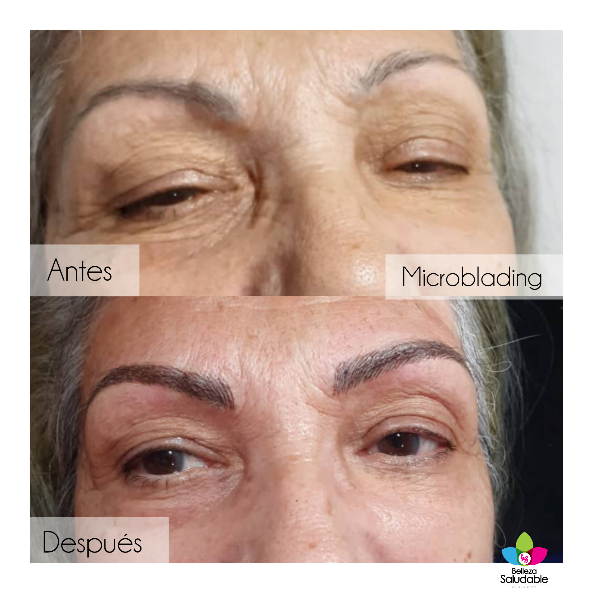 Resultado