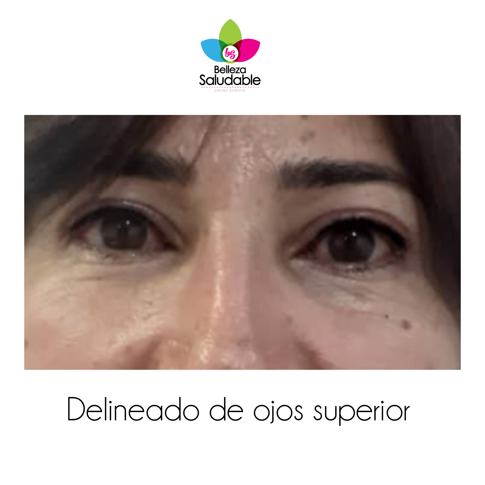 Resultado