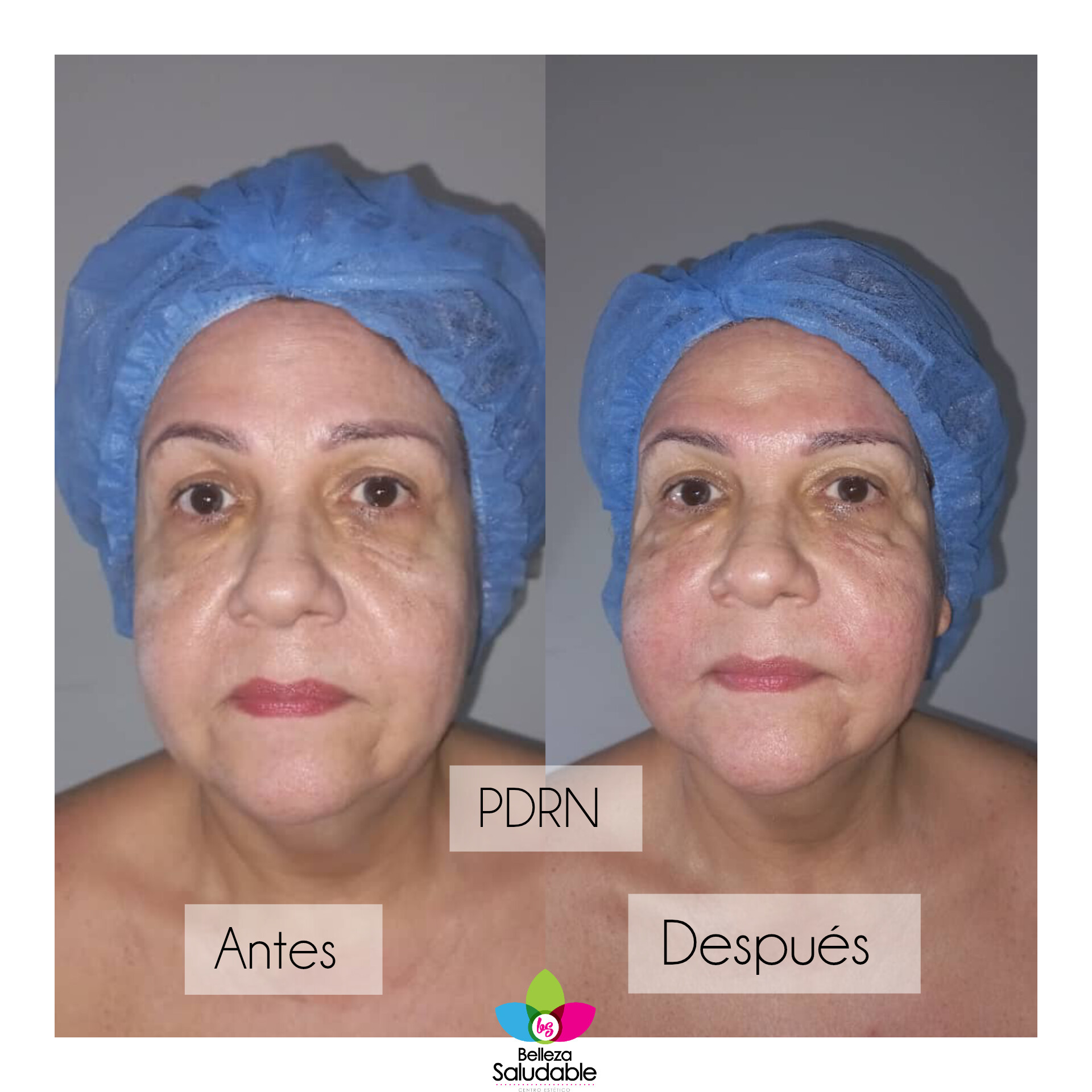 Resultado