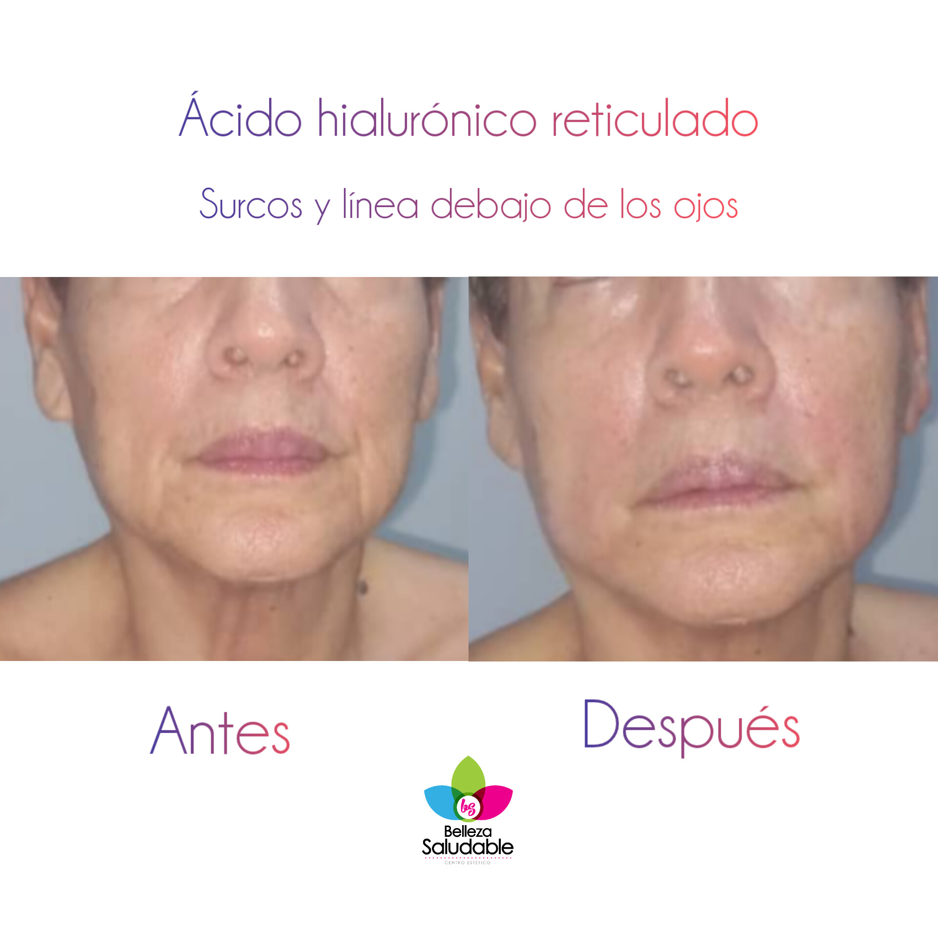 Resultado