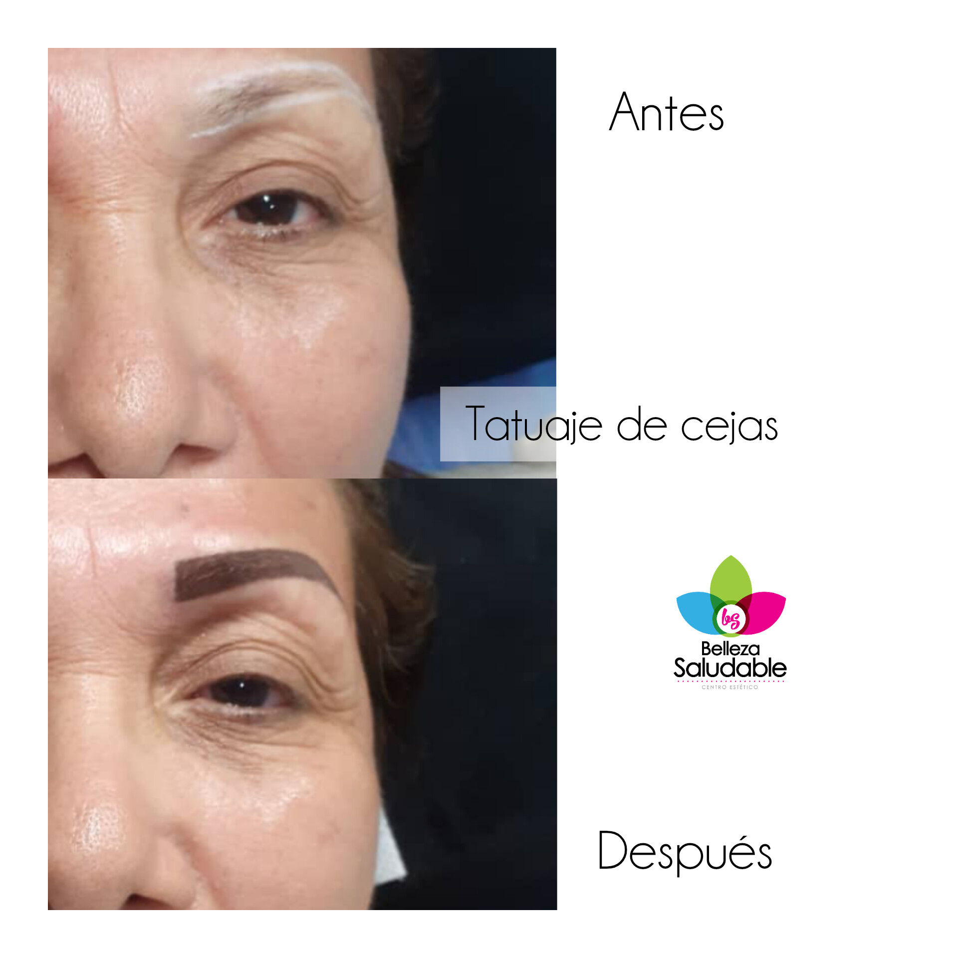 Resultado