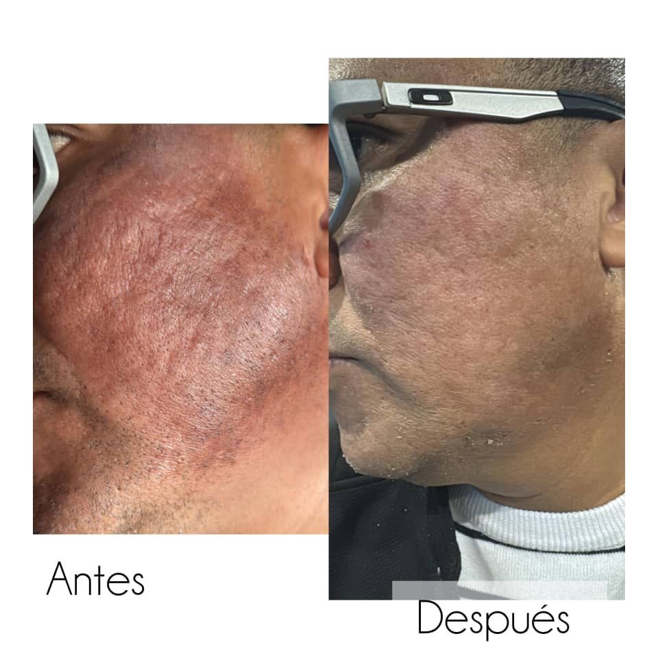 Resultado