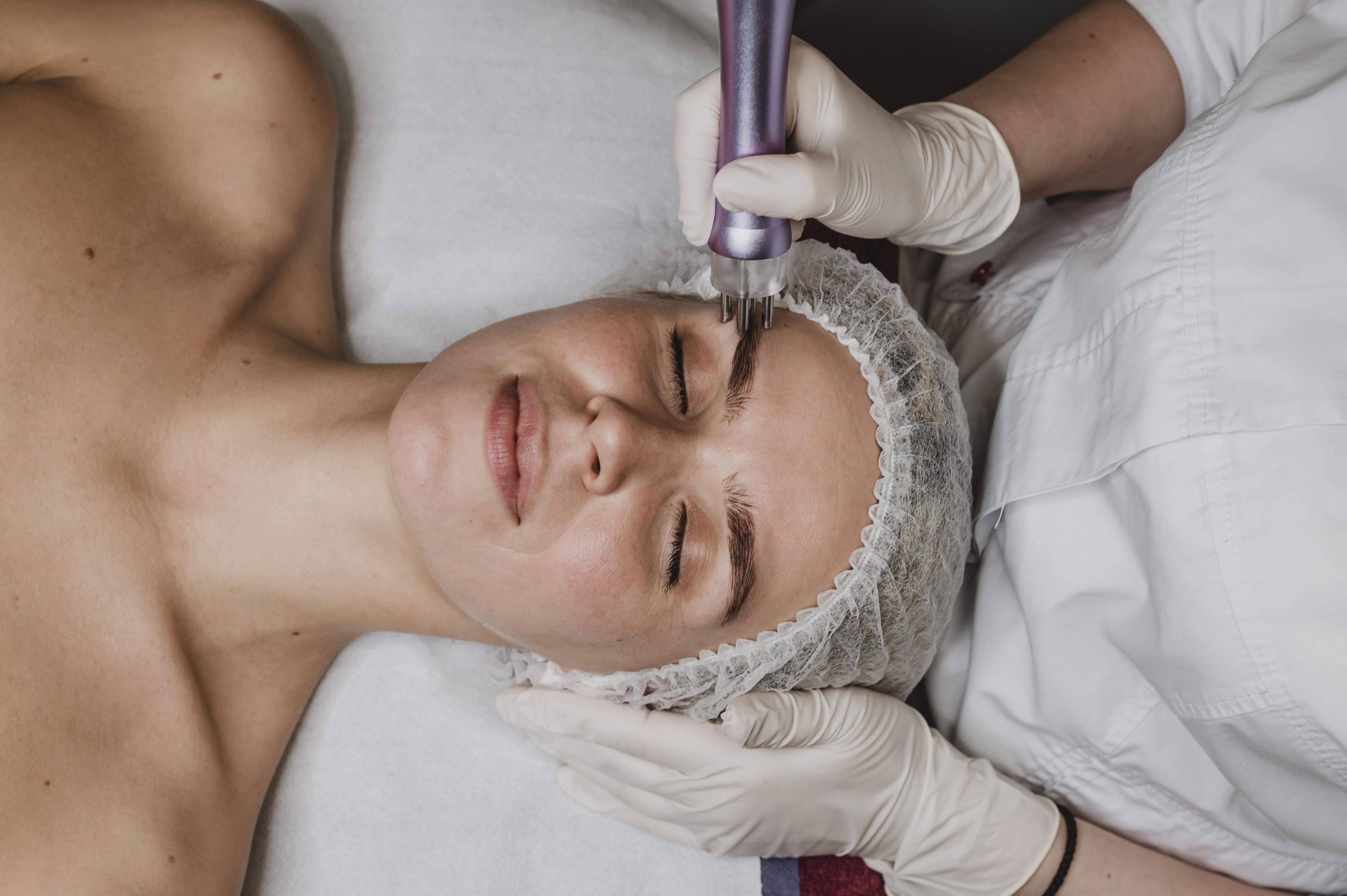 Radiofrecuencia facial 